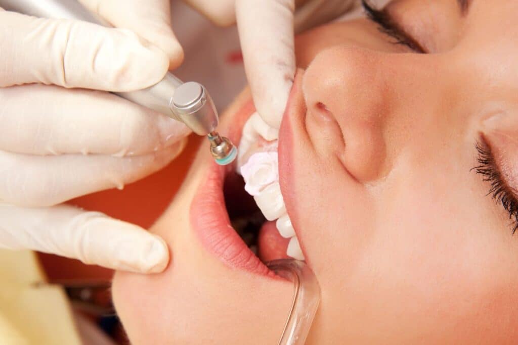 Cosmetic Bonding Before and After Cosmetic Dentistry Dentist in Phoenix AZ at 7 North Dental