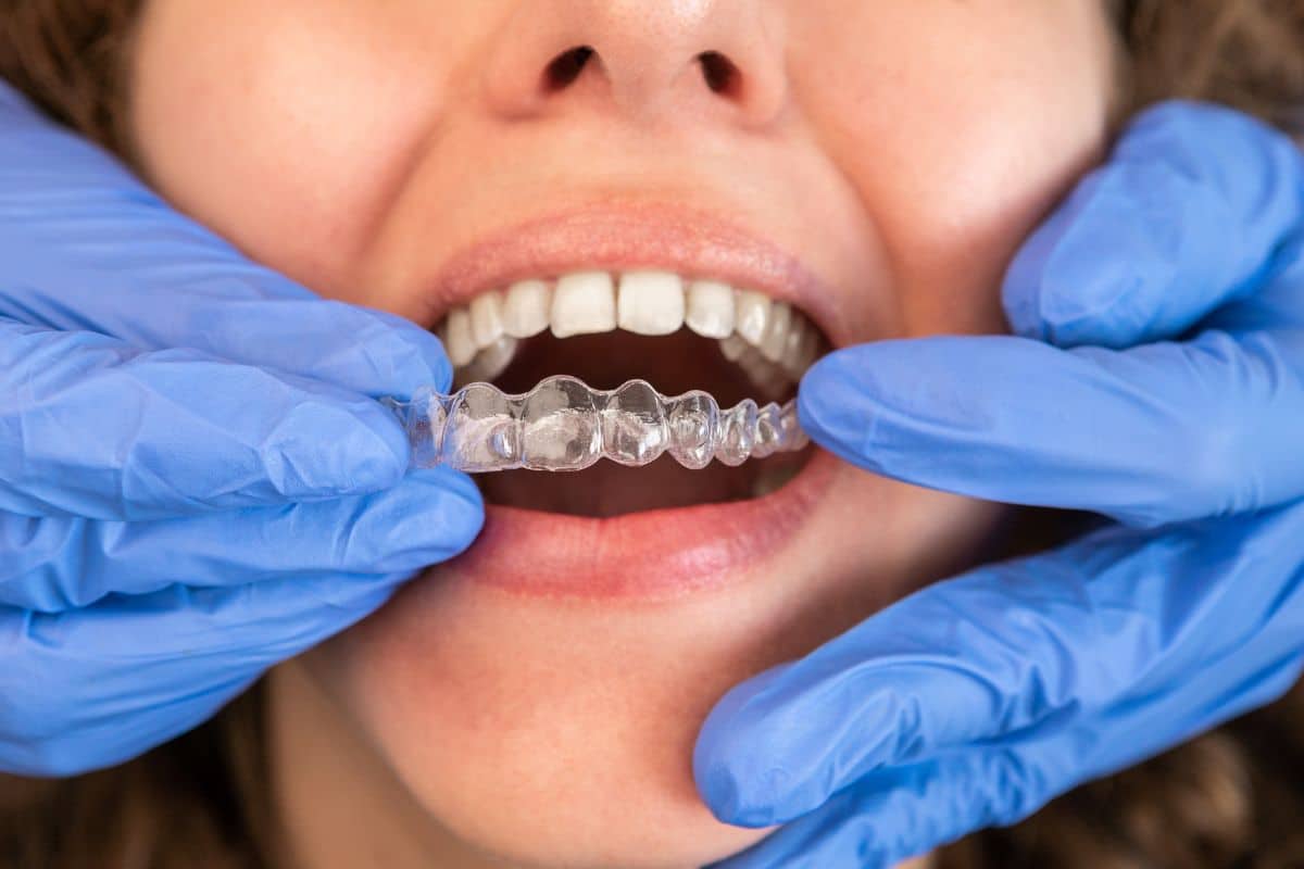 Invisalign Treatment Before and After Cosmetic Dentistry Dentist in Phoenix AZ at 7 North Dental