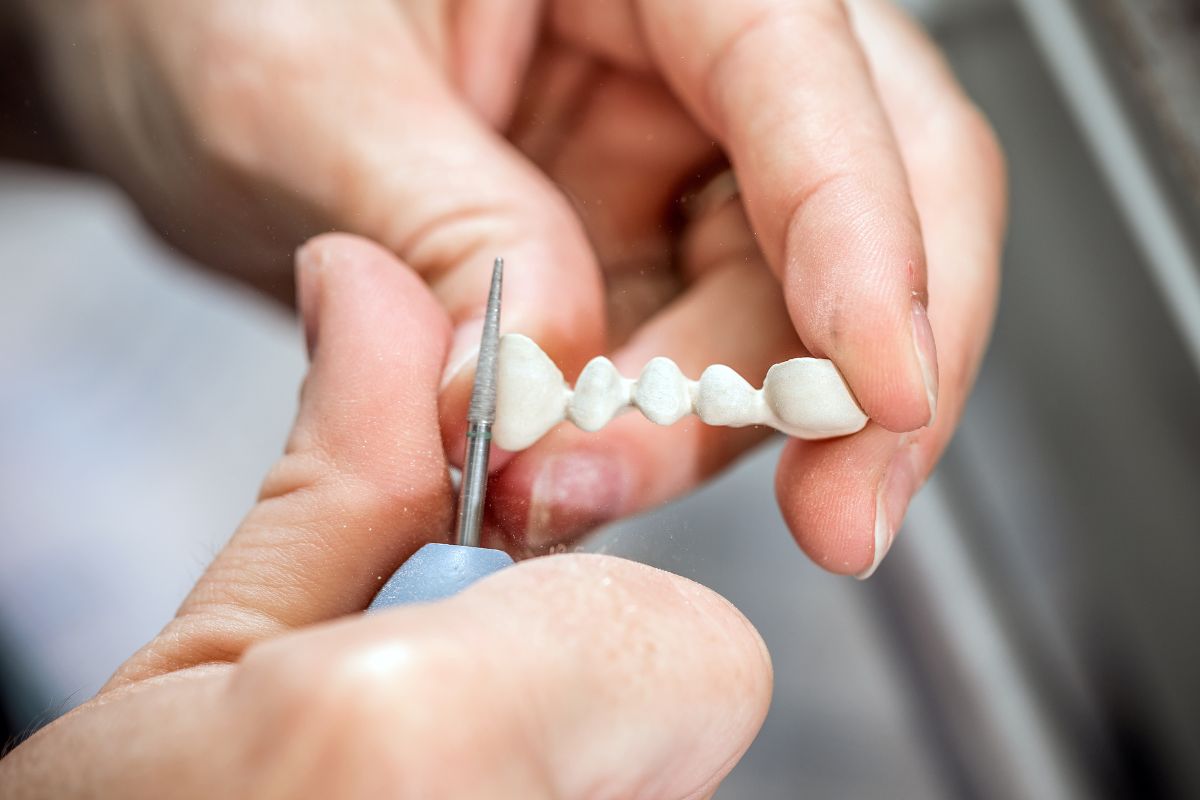 Crowns in Phoenix: Get custom-made dental crowns in Phoenix at 7 North Dental