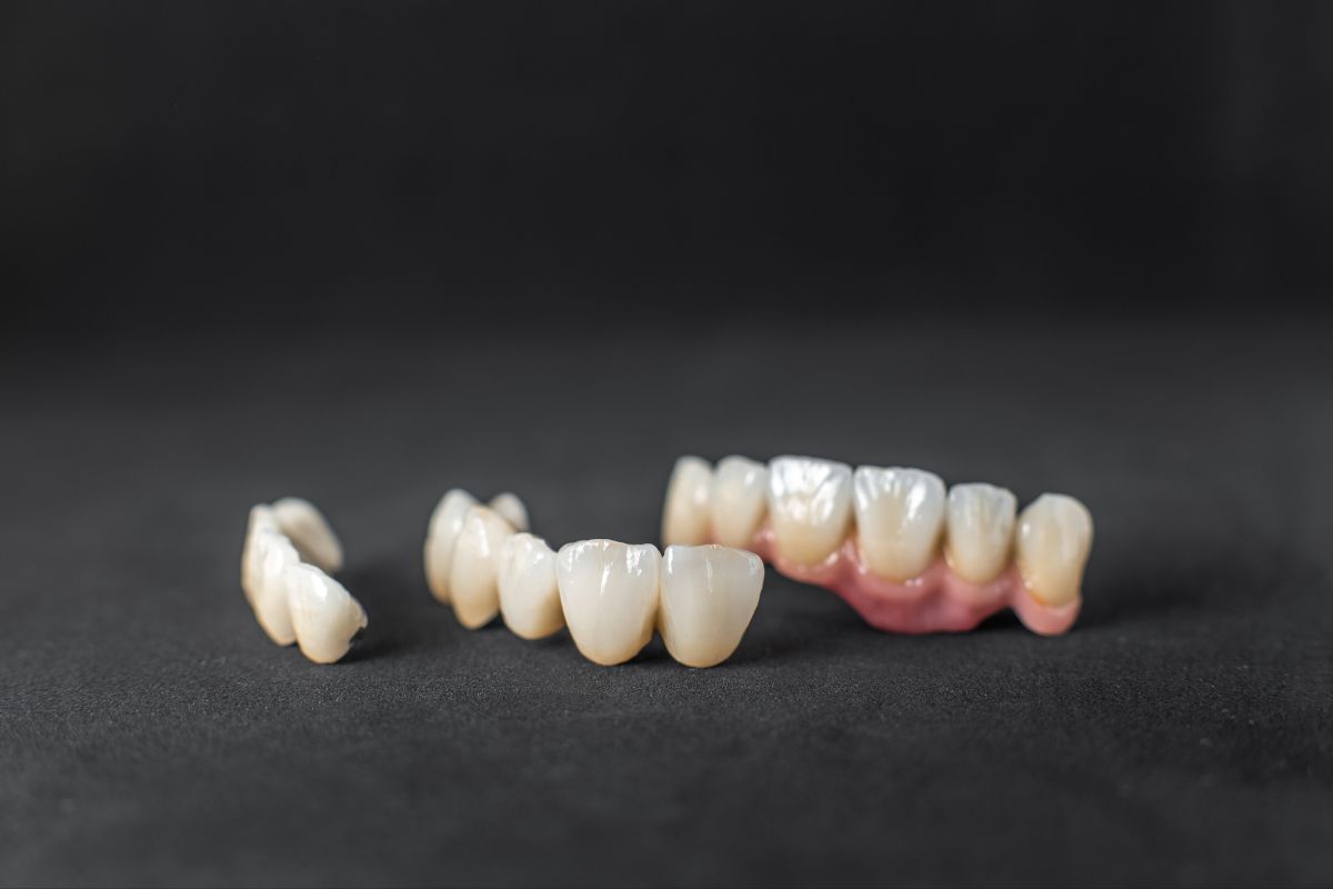 What to Do If Your Dental Crown Falls Out